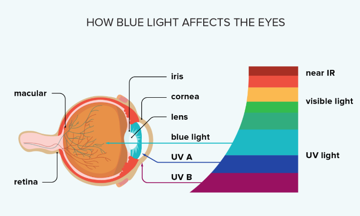 How blue light affects the eyes